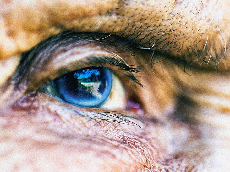 Cataracts and diabetes: Relationship, symptoms, treatment