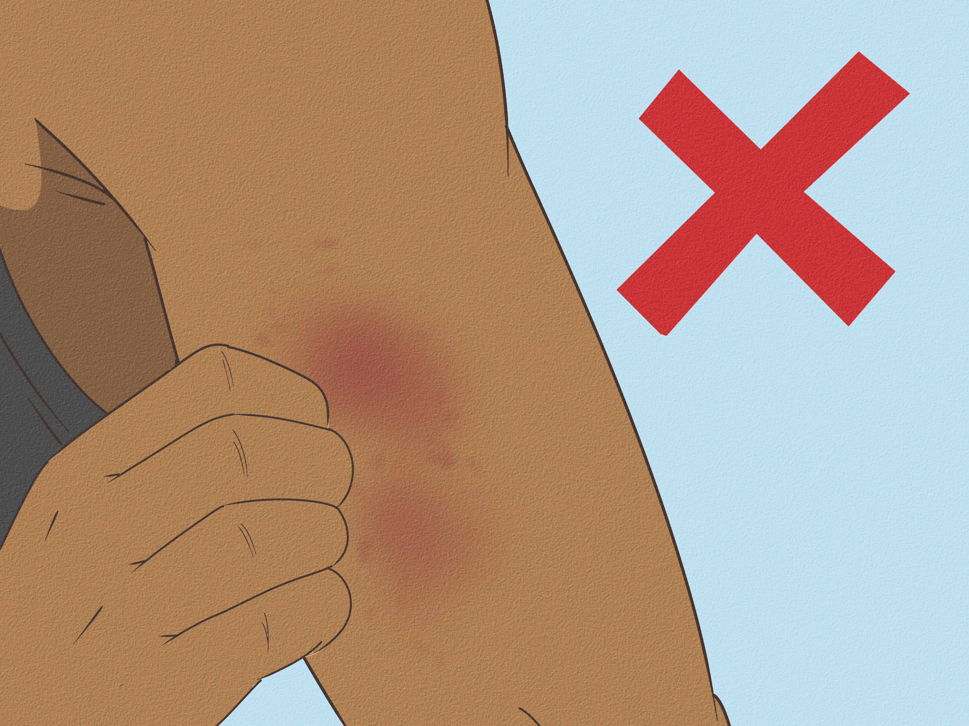 How to Wash Icy Hot off Fast: Stop Burning & Irritation